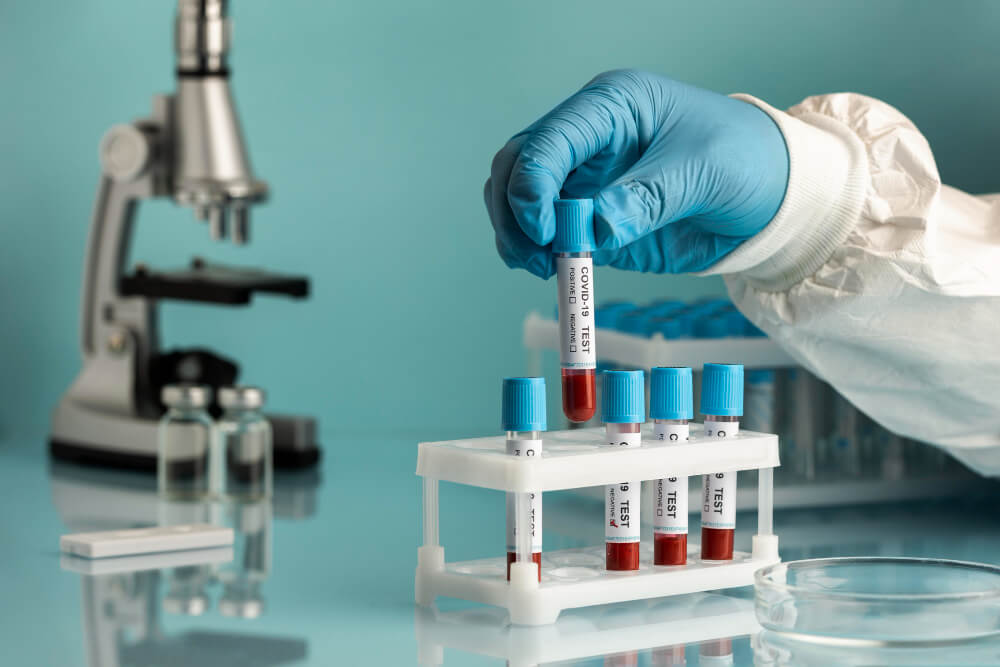 Best Pathology Labs In Anand